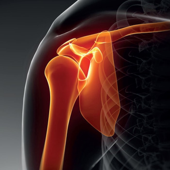 испытания имплантов фото 3