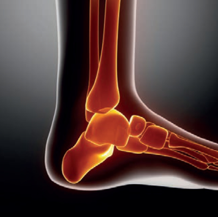 испытания имплантов фото 5